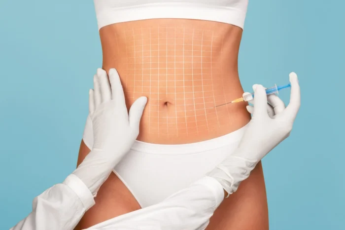 How Long Do Lipolytic Results Last? What You Need to Know!