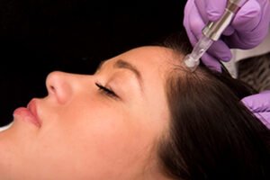 How Mesotherapy Instruments Can Treat Hair Loss, Wrinkles, and More!
